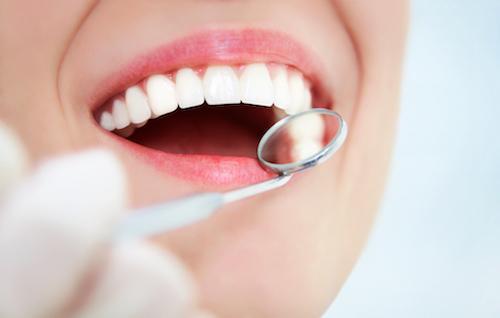Person at Dentist | Dental Exams in Randwick NSW