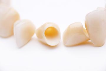 Dental Crowns in Randwick NSW