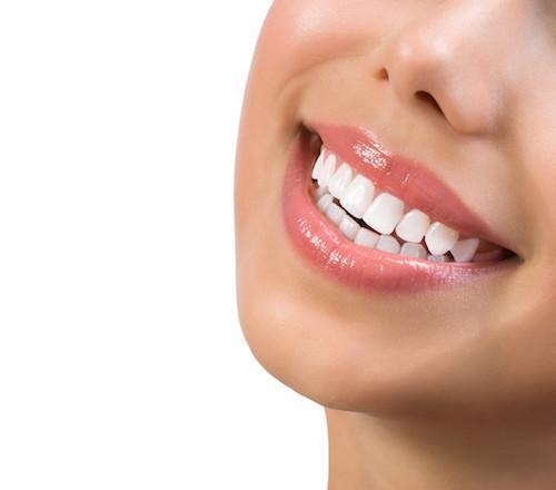 Woman | Tooth Colored Fillings in Randwick NSW